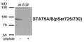 Western blot analysis of extracts from Jurkat cells treated with EGF using Phospho-STAT5A/B (Ser725/730) antibody.The lane on the right is treated with the antigen-specific peptide.