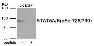 Western blot analysis of extracts from Jurkat cells treated with EGF using Phospho-STAT5A/B (Ser725/730) antibody.The lane on the right is treated with the antigen-specific peptide.