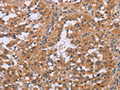 CDK1 Antibody – Figure 1 of 3