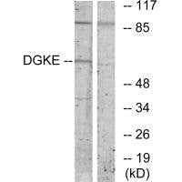 Western blot analysis of extracts from K562 cells, using DGKE antibody.
