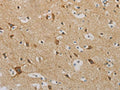 The image on the left is immunohistochemistry of paraffin-embedded Human brain tissue using CSB-PA952993(IDH3G Antibody) at dilution 1/30, on the right is treated with fusion protein. (Original magnification: ×200)