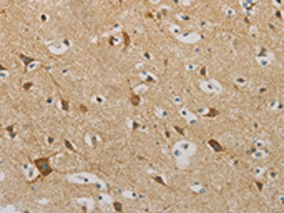 The image on the left is immunohistochemistry of paraffin-embedded Human brain tissue using CSB-PA952993(IDH3G Antibody) at dilution 1/30, on the right is treated with fusion protein. (Original magnification: ×200)