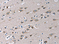 The image on the left is immunohistochemistry of paraffin-embedded Human brain tissue using CSB-PA953581(TLR1 Antibody) at dilution 1/20, on the right is treated with fusion protein. (Original magnification: ×200)