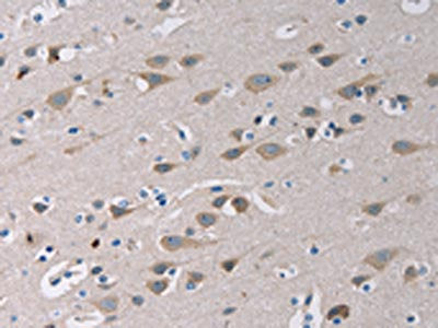 The image on the left is immunohistochemistry of paraffin-embedded Human brain tissue using CSB-PA953581(TLR1 Antibody) at dilution 1/20, on the right is treated with fusion protein. (Original magnification: ×200)