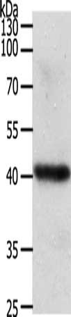 Gel: 10%SDS-PAGE, Lysate: 50 ug, Lane: Lovo cells, Primary antibody: CSB-PA953770(WNT9A Antibody) at dilution 1/200, Secondary antibody: Goat anti rabbit IgG at 1/8000 dilution, Exposure time: 30 seconds
