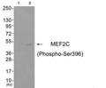 Western blot analysis of extracts from cos-7 cells (Lane 2), using MEF2C (Phospho-Ser396) Antibody. The lane on the left is treated with antigen-specific peptide.