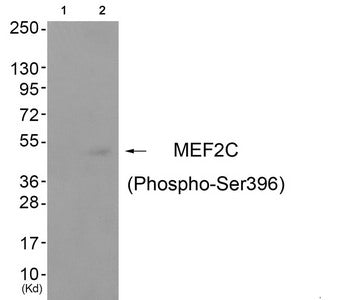 Western blot analysis of extracts from cos-7 cells (Lane 2), using MEF2C (Phospho-Ser396) Antibody. The lane on the left is treated with antigen-specific peptide.