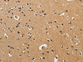 The image on the left is immunohistochemistry of paraffin-embedded Human brain tissue using CSB-PA954269(CST6 Antibody) at dilution 1/70, on the right is treated with fusion protein. (Original magnification: ×200)