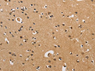 The image on the left is immunohistochemistry of paraffin-embedded Human brain tissue using CSB-PA954269(CST6 Antibody) at dilution 1/70, on the right is treated with fusion protein. (Original magnification: ×200)