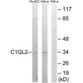 Western blot analysis of extracts from HUVEC cells and HeLa cells, using C1QL2 antibody.
