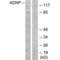 Western blot analysis of extracts from LOVO cells, using ADNP antibody.