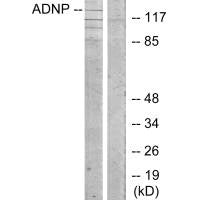 Western blot analysis of extracts from LOVO cells, using ADNP antibody.