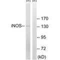 Western blot analysis of extracts from 3T3 cells, using iNOS (Ab-151) antibody.