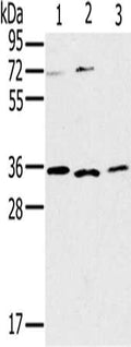 Gel: 10%SDS-PAGE, Lysate: 40 ug, Lane 1-3: SP20 cells, Raji cells, 231 cells, Primary antibody: CSB-PA955318(IL22RA2 Antibody) at dilution 1/200, Secondary antibody: Goat anti rabbit IgG at 1/8000 dilution, Exposure time: 10 minutes