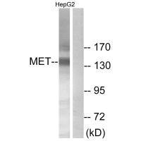 Western blot analysis of extracts from HepG2 cells, using Met (Ab-1234) antibody.