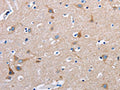 The image on the left is immunohistochemistry of paraffin-embedded Human brain tissue using CSB-PA955751(FN1 Antibody) at dilution 1/50, on the right is treated with fusion protein. (Original magnification: ×200)