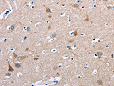 The image on the left is immunohistochemistry of paraffin-embedded Human brain tissue using CSB-PA955751(FN1 Antibody) at dilution 1/50, on the right is treated with fusion protein. (Original magnification: ×200)