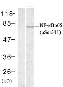 Western blot analysis of extracts from Hela cells untreated or treated with IFN-α  using NFκ;B-p65((phospho-Ser311) Antibody.