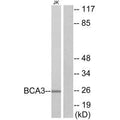 Western blot analysis of extracts from Jurkat cells, using BCA3 antibody.