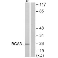 Western blot analysis of extracts from Jurkat cells, using BCA3 antibody.