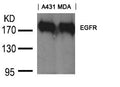 Western blot analysis of extracts from A431 and MDA cells using EGFR(Ab-1197) goat polyclonal antibody.