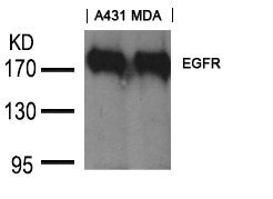 Western blot analysis of extracts from A431 and MDA cells using EGFR(Ab-1197) goat polyclonal antibody.