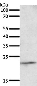 Gel: 12%SDS-PAGE Lysates (from left to right): Mouse liver tissue Amount of lysate: 50ug per lane Primary antibody: 1/250 dilution Secondary antibody dilution: 1/8000 Exposure time: 40 seconds