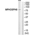 Western blot analysis of extracts from A549 cells, using MPHOSPH9 antibody.
