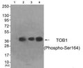 Western blot analysis of extracts from HeLa cells (Lane 2), A549 cells (Lane 3) and HepG2 cells (Lane 4), using TOB1 (Phospho-Ser164) Antibody. The lane on the left is treated with antigen-specific peptide.
