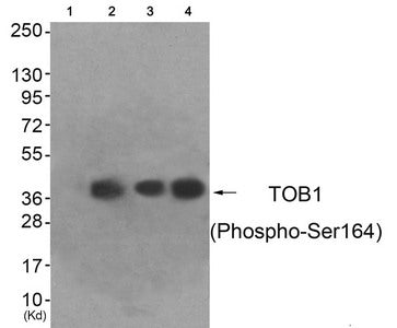 Western blot analysis of extracts from HeLa cells (Lane 2), A549 cells (Lane 3) and HepG2 cells (Lane 4), using TOB1 (Phospho-Ser164) Antibody. The lane on the left is treated with antigen-specific peptide.