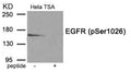 Western blot analysis of extracts from HeLa cells treated with TSA using Phospho-EGFR (Ser1026) antibody.The lane on the right is treated with the antigen-specific peptide.