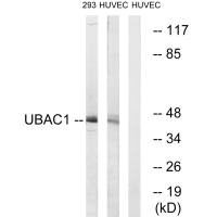 Western blot analysis of extracts from 293 cells and HUVEC cells, using UBAC1 antibody.