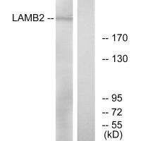 Western blot analysis of extracts from RAW264.7 cells, using LAMB2 antibody.