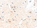 The image on the left is immunohistochemistry of paraffin-embedded Human brain tissue using CSB-PA958079(SLC19A2 Antibody) at dilution 1/15, on the right is treated with fusion protein. (Original magnification: ×200)