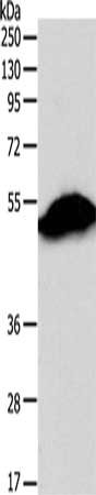 Gel: 10%SDS-PAGE, Lysate: 40 ug, Lane: Mouse stomach tissue, Primary antibody: CSB-PA959450(SIRT6 Antibody) at dilution 1/300, Secondary antibody: Goat anti rabbit IgG at 1/8000 dilution, Exposure time: 5 seconds