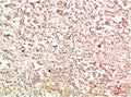 ABL1 Antibody – Figure 1 of 2