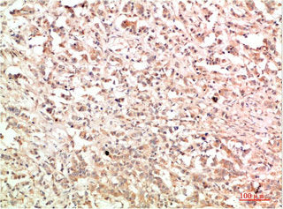 ABL1 Antibody – Figure 1 of 2