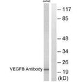Western blot analysis of extracts from Jurkat cells, using VEGFB antibody.