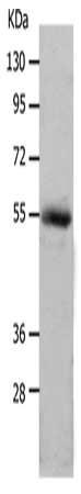 Gel: 10+12%SDS-PAGE, Lysate: 40 ug, Lane: Human colon cancer tissue, Primary antibody: CSB-PA959529(MMP17 Antibody) at dilution 1/550, Secondary antibody: Goat anti rabbit IgG at 1/8000 dilution, Exposure time: 2 minutes