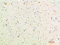 Immunohistochemical analysis of paraffin-embedded human-brain, antibody was diluted at 1:200