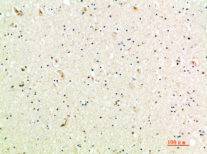 Immunohistochemical analysis of paraffin-embedded human-brain, antibody was diluted at 1:200
