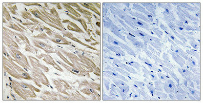 Immunohistochemistry analysis of paraffin-embedded human heart tissue using PPP1R2 (Phospho-Ser120+Ser121) antibody. The picture on the right is treated with the synthesized peptide.
