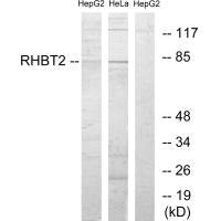 Western blot analysis of extracts from HepG2 cells and HeLa cells, using RHBT2 antibody.