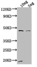 Western Blot
Positive WB detected in Recombinant protein
All lanes: VAM6 antibody at 1:2000
Secondary
Goat polyclonal to rabbit IgG at 1/50000 dilution
Predicted band size: 42 kDa
Observed band size: 44 kDa