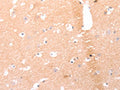 The image on the left is immunohistochemistry of paraffin-embedded Human brain tissue using CSB-PA960464(AMH Antibody) at dilution 1/25, on the right is treated with synthetic peptide. (Original magnification: ×200)