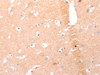 The image on the left is immunohistochemistry of paraffin-embedded Human brain tissue using CSB-PA960464(AMH Antibody) at dilution 1/25, on the right is treated with synthetic peptide. (Original magnification: ×200)
