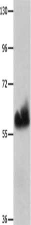 Gel: 10%SDS-PAGE, Lysate: 60 ug, Lane: 231 cells, Primary antibody: CSB-PA960543(HPSE Antibody) at dilution 1/100, Secondary antibody: Goat anti rabbit IgG at 1/8000 dilution, Exposure time: 5 minutes