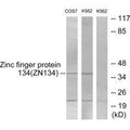 Western blot analysis of extracts from COS-7 cells and K562 cells, using ZNF134 antibody.