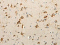 The image on the left is immunohistochemistry of paraffin-embedded Human brain tissue using CSB-PA961254(RPAP3 Antibody) at dilution 1/15, on the right is treated with fusion protein. (Original magnification: ×200)