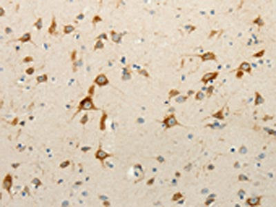The image on the left is immunohistochemistry of paraffin-embedded Human brain tissue using CSB-PA961254(RPAP3 Antibody) at dilution 1/15, on the right is treated with fusion protein. (Original magnification: ×200)